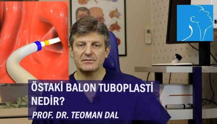 ostaki-balon-tuboplasti-nedir-prof-dr-teoman-dal