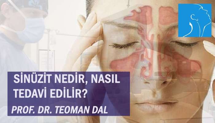 sinüzit,kronik sinüzit,sinüzit tedavisi,sinüzit ameliyatı,sinüs cerrahisi,endoskopik sinüs cerrahisi,uyku apnesi,BOS fistülü,bos fistülü ameliyatı,beyin omurilik sıvısı,bos fistülü onarımı,csf fistula repair,csf fistula,csf leak treatme