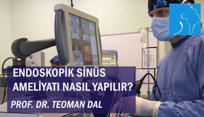sinüzit,kronik sinüzit,sinüzit tedavisi,sinüzit ameliyatı,sinüs cerrahisi,endoskopik sinüs cerrahisi,dudak dolgusu,dr. teoman dal,üç boyutlu görüntüleme,endoskopik sinüs ameliyatı,endoskopik sinüs cerrahisi ameliyatı izle,endoskopik sinüs