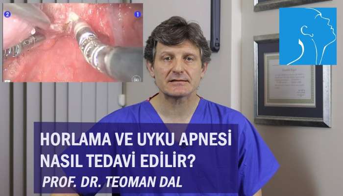 dr. teoman dal,üç boyutlu görüntüleme,burun eğriliği,horlama,uyku apnesi,uyku apnesi tedavisi,obstrüktif uyku apnesi,obstrüktif uyku apnesi tedavisi,sleep apnea,horlama tedavisi,horlama ameliyatı,horlama maskesi,uyku testi,uyku bozuklukları,apn