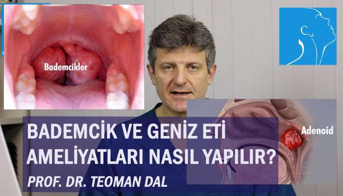 sinüzit,kronik sinüzit,sinüzit tedavisi,sinüzit ameliyatı,sinüs cerrahisi,endoskopik sinüs cerrahisi,ameliyatsız yüz germe,dr. teoman dal,horlama,uyku apnesi,uyku apnesi tedavisi,bademcik ameliyatı,tonsillektomi,geniz eti ameliyatı,geniz eti am