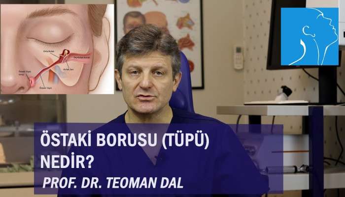 sinüzit,kronik sinüzit,sinüzit tedavisi,sinüzit ameliyatı,sinüs cerrahisi,endoskopik sinüs cerrahisi,dr. teoman dal,burun eğriliği,östaki tüpü,östaki borusu,östaki kanalı,östeki tüpü tıkanıklığı,patuolus östaki,östaki balon tubopl