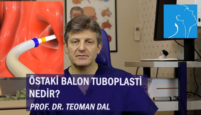 sinüzit,kronik sinüzit,sinüzit tedavisi,sinüzit ameliyatı,sinüs cerrahisi,endoskopik sinüs cerrahisi,dr. teoman dal,östaki borusu,östaki disfonksiyonu,östaki balon tuboplasti ameliyatı,balon östaki tuboplasti,östaki balon dilatasyonu,östaki