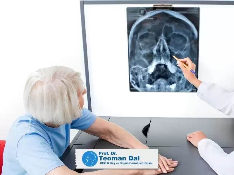endoskopik-sinus-cerrahisi-esc-nedir