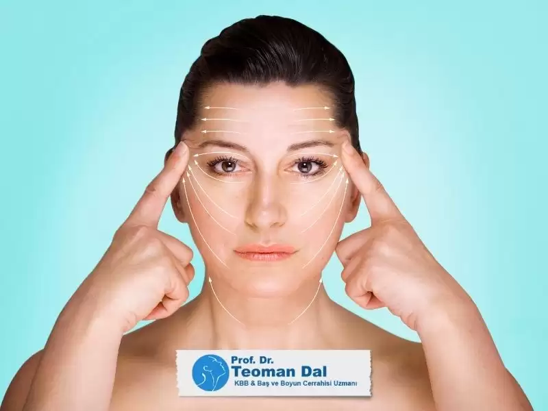 İple Yüz Gençleştirme Nedir?