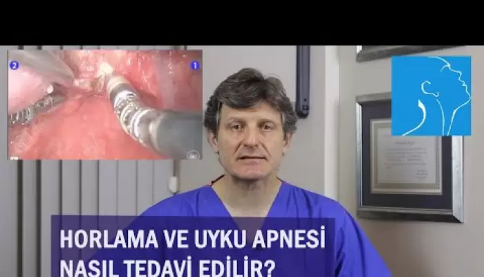 dr. teoman dal,üç boyutlu görüntüleme,burun eğriliği,horlama,uyku apnesi,uyku apnesi tedavisi,obstrüktif uyku apnesi,obstrüktif uyku apnesi tedavisi,sleep apnea,horlama tedavisi,horlama ameliyatı,horlama maskesi,uyku testi,uyku bozuklukları,apn